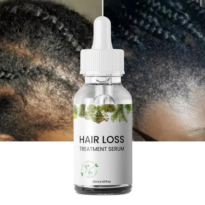 Hair Loss Treatment Serum 30Ml (Pack Of 1)