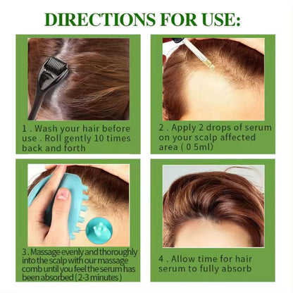 Hair Loss Treatment Serum 30Ml (Pack Of 1)