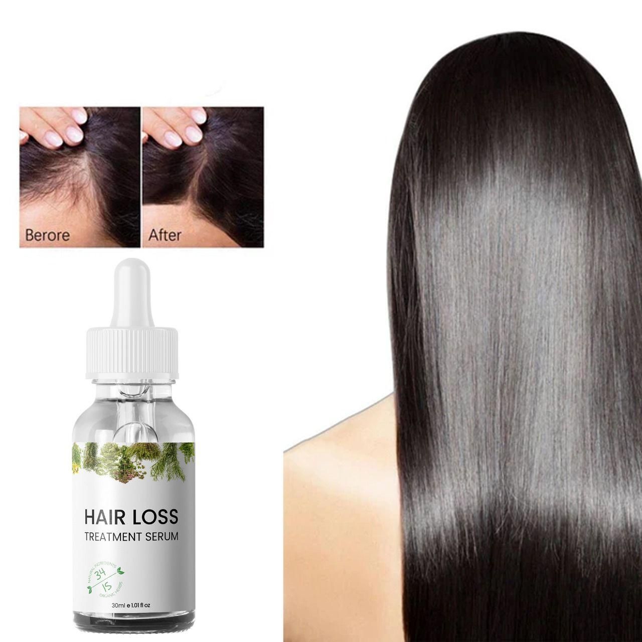 Hair Loss Treatment Serum 30Ml (Pack Of 1)
