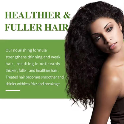 Hair Loss Treatment Serum 30Ml (Pack Of 1)